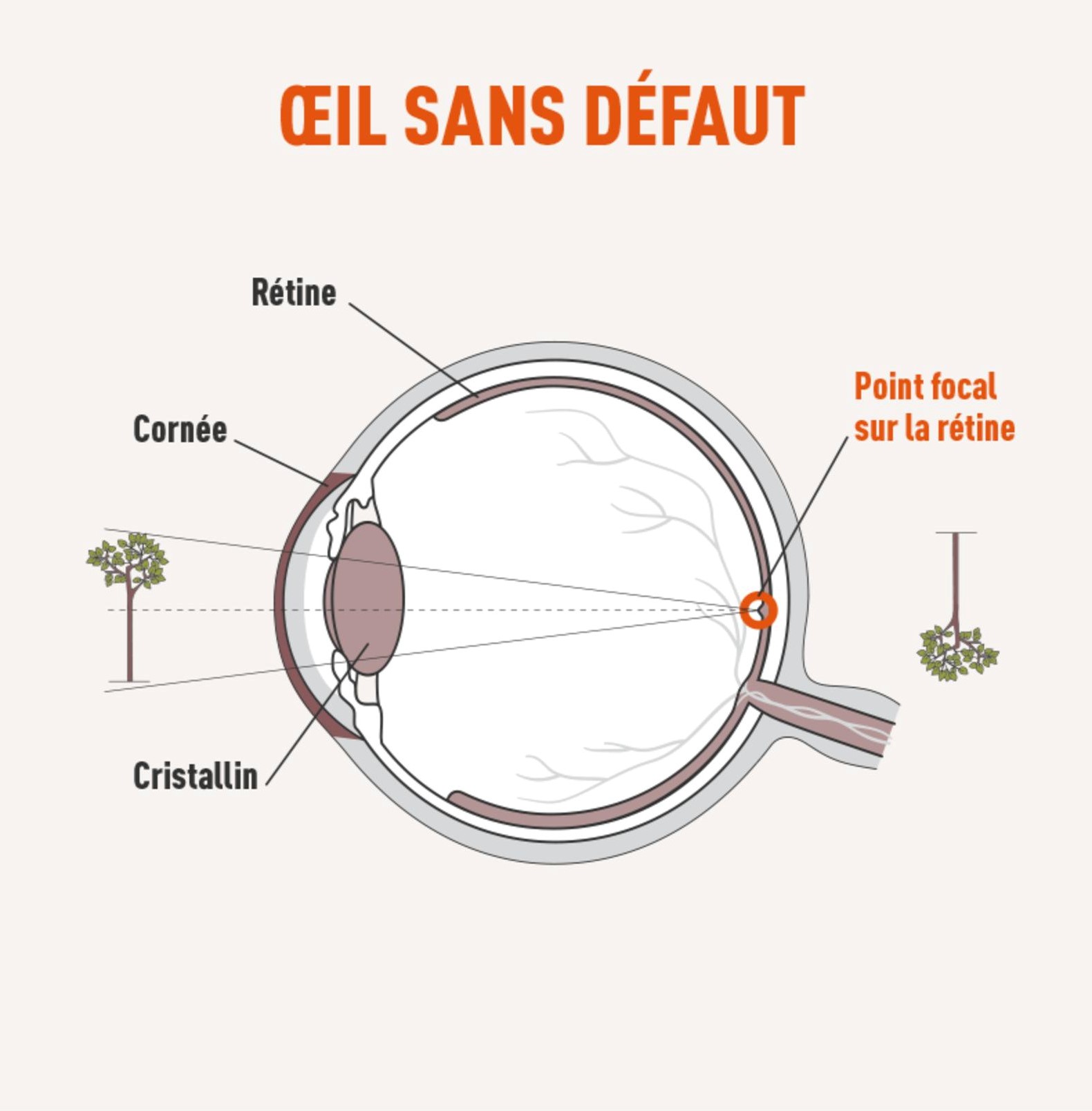 Oeil sans défaut