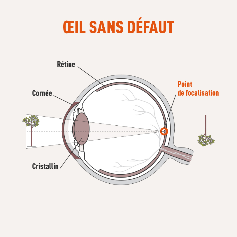 Oeil sans défaut