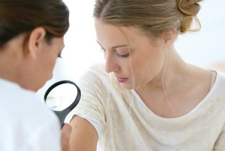 Prévention des cancers de la peau